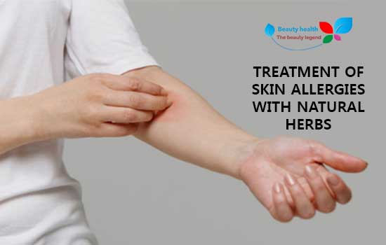 Treatment of skin allergies with natural herbs - remedii homeopate pentru alergii cutanate
