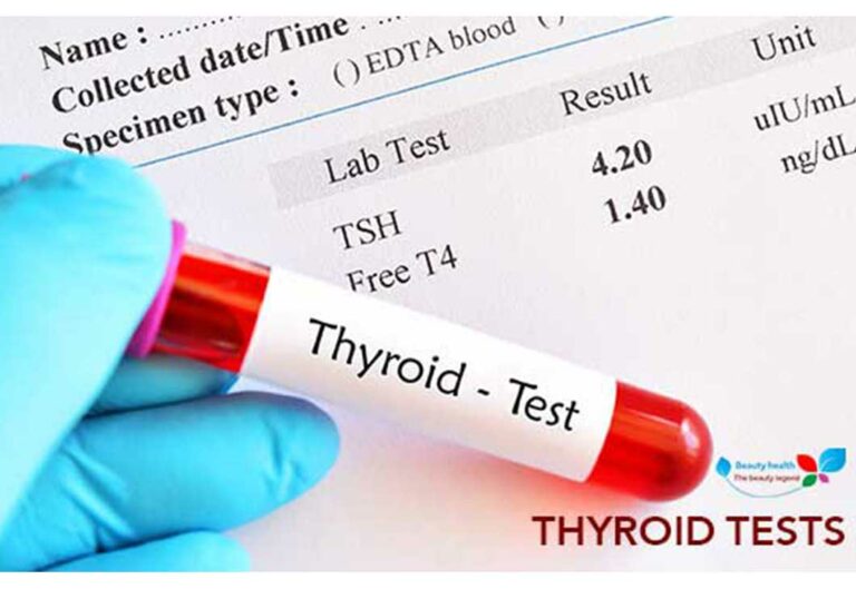 Thyroid tests