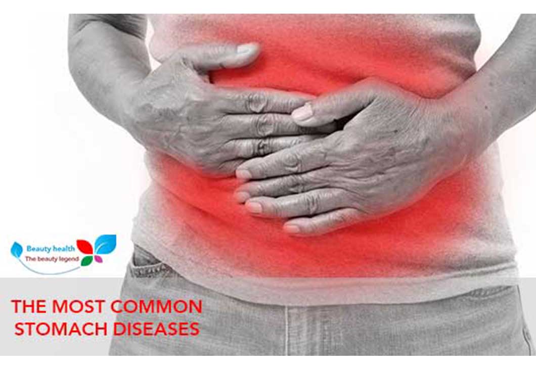 The Most Common Stomach Diseases Health Beauty