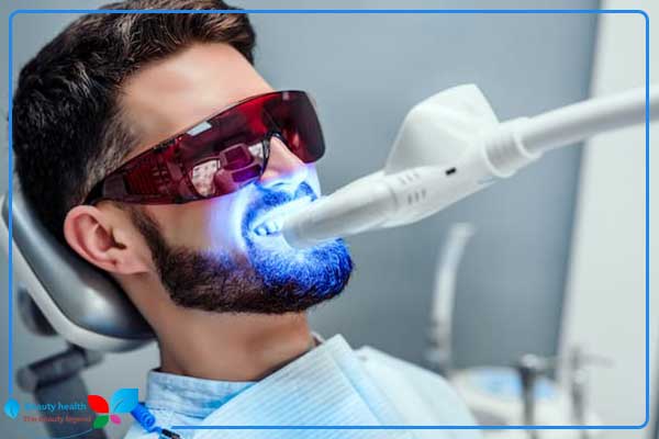 Angebote zur Zahnaufhellung mit Laser