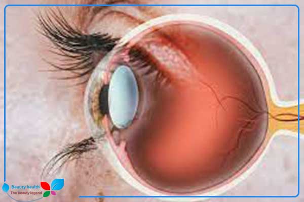 Er øyeoperasjoner med laser farlig?