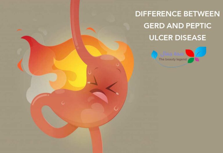 Difference between GERD and peptic ulcer disease