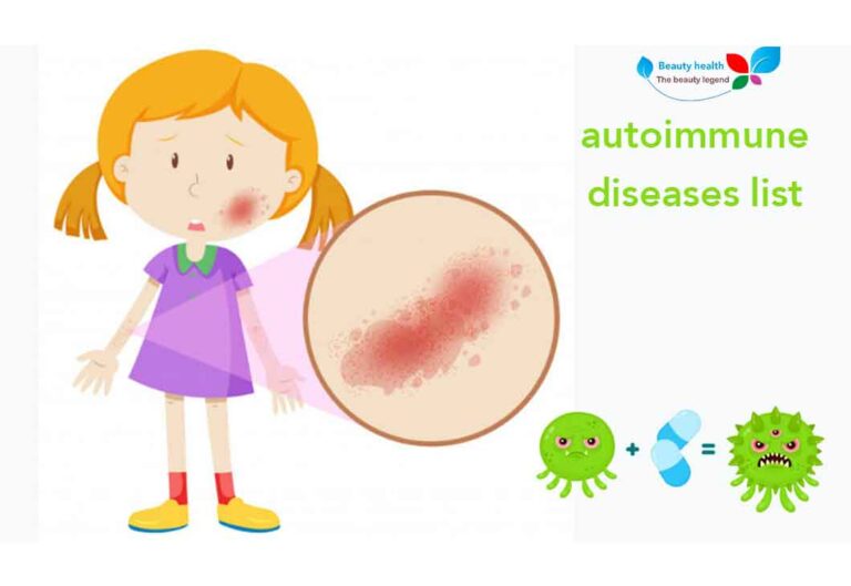 autoimmune diseases list