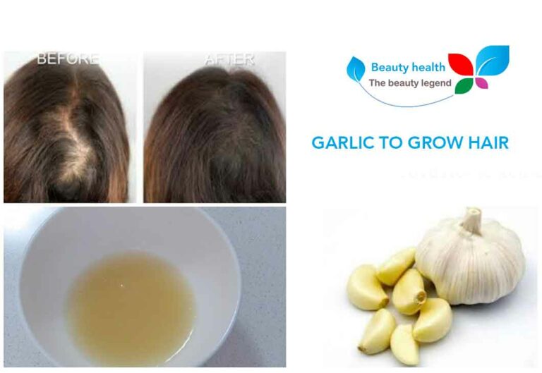 garlic to grow hair on the front of the head