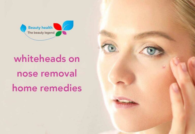 whiteheads on nose removal home remedies
