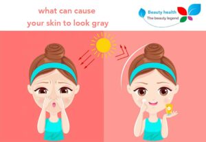 What Can Cause Your Skin To Look Gray 300x207 