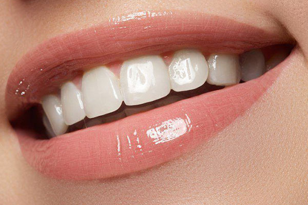 Hollywood Smile Turkey