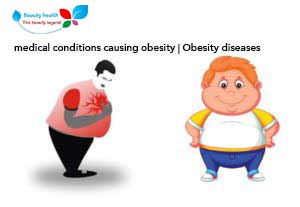 medical conditions causing obesity | Obesity diseases