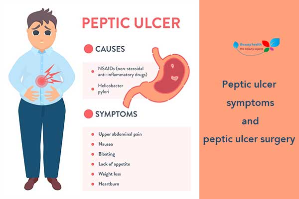 Peptic ulcer symptoms and peptic ulcer surgery