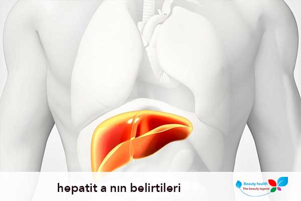 hepatit a nın belirtileri