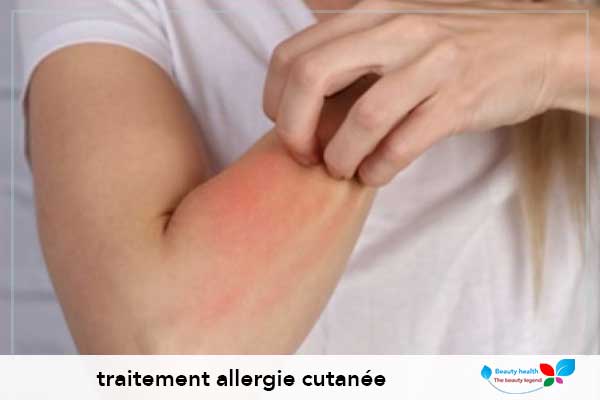 traitement allergie cutanée