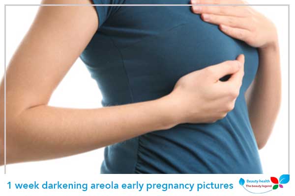1 week darkening areola early pregnancy pictures