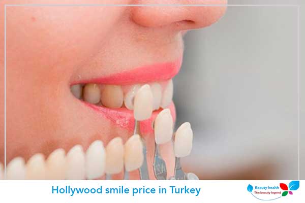 Hollywood smile price in Turkey