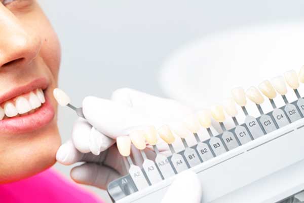 hollywood-smile-price-in-turkey