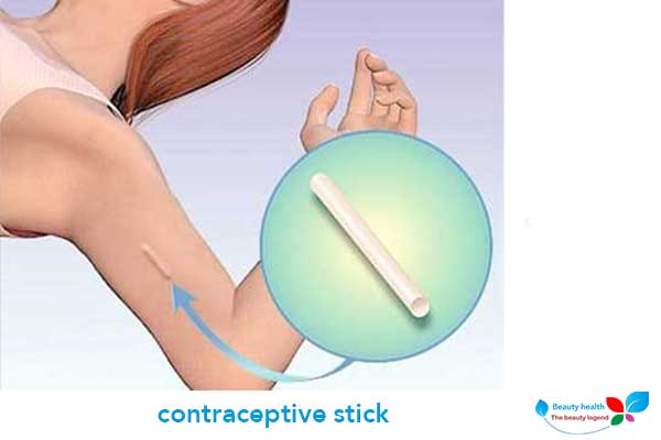 contraceptive stick