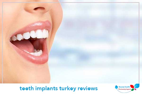 teeth implants turkey reviews