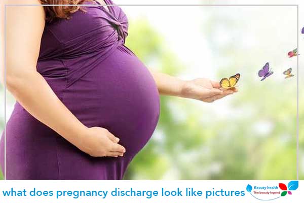 what does pregnancy discharge look like pictures
