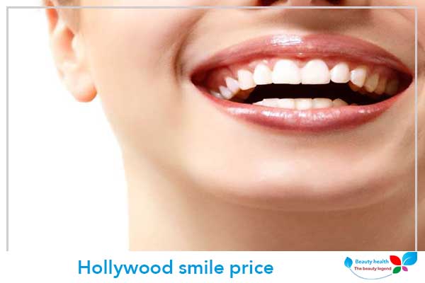 hollywood smile price