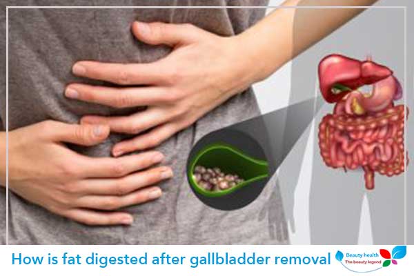 How Is Fat Digested After Gallbladder Removal |health Beauty