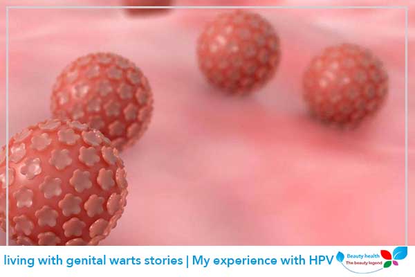 living with genital warts stories | My experience with HPV