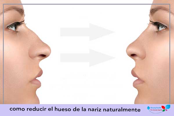 como reducir el hueso de la nariz naturalmente