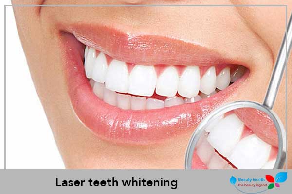 Laser teeth whitening