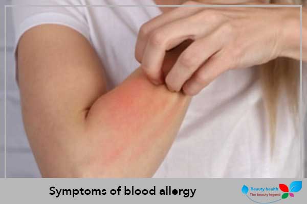 Symptoms of blood allergy