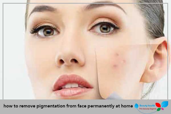 how to remove pigmentation from face permanently at home