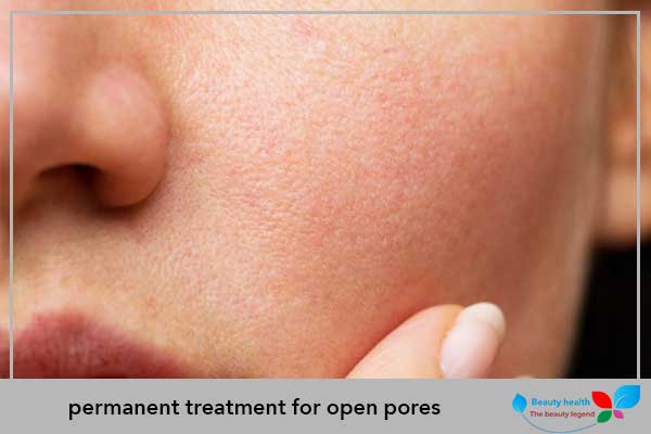 permanent treatment for open pores