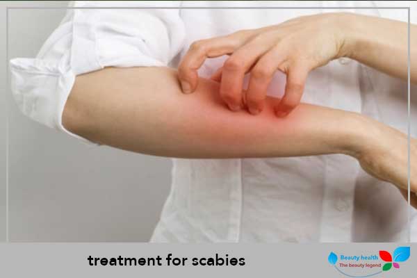 Immediate treatment for scabies