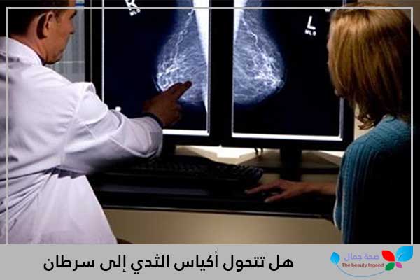 هل تتحول أكياس الثدي إلى سرطان
