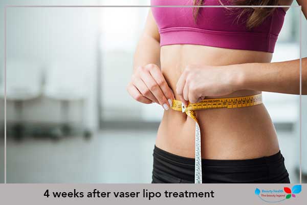 4 weeks after vaser lipo treatment