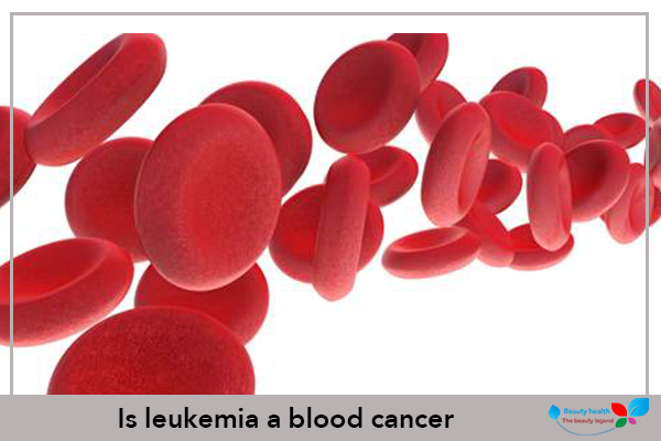Is leukemia a blood cancer