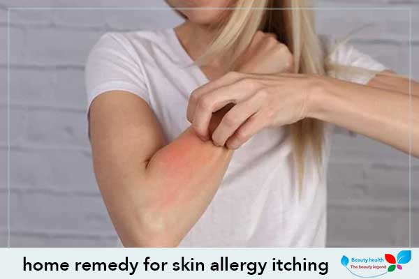 home remedy for skin allergy itching