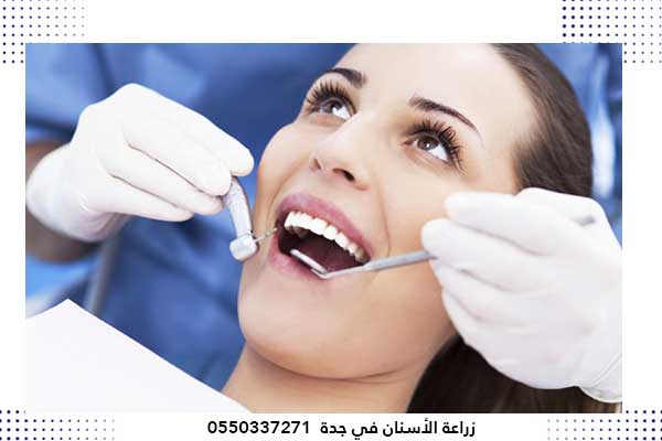 اسعار عروض تجميل الاسنان في جدة السعودية – أفضل طبيب و عيادة