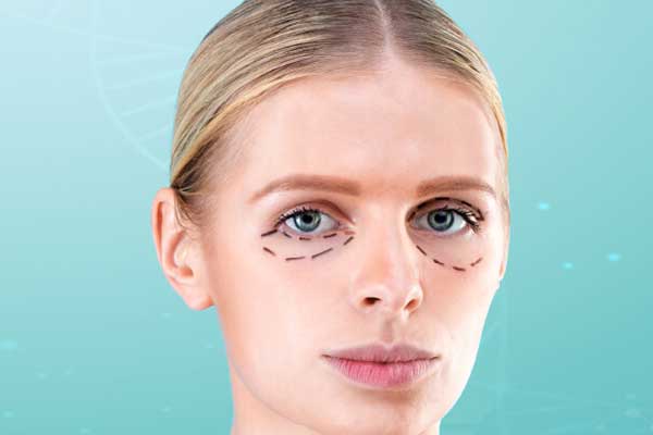 Lower Eyelid Surgery (Lower Blepharoplasty)