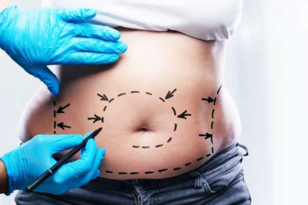 Water-Assisted Liposuction (WAL)
