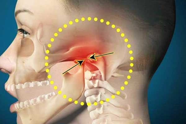 Comprehensive Guide to TMD Treatment: Alleviating Jaw Pain and Discomfort