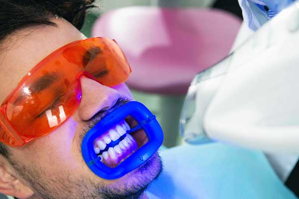 in office teeth whitening: A Comprehensive Guide to Achieving a Brighter Smile
