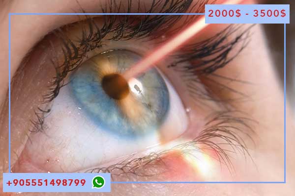 лазерная коррекция зрения стамбул: доступная цена и высокое качество
