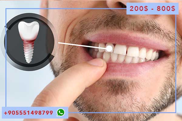протезирование зубов в турции отзывы