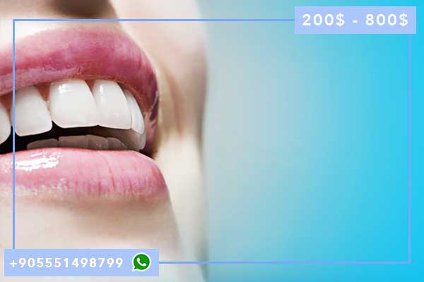 стоматология анталия: Ваш Путеводитель к Здоровой Улыбке