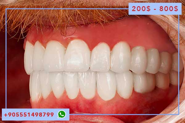 10 Причин Выбрать стоматология в стамбуле цены, Качество и Отзывы Пациентов
