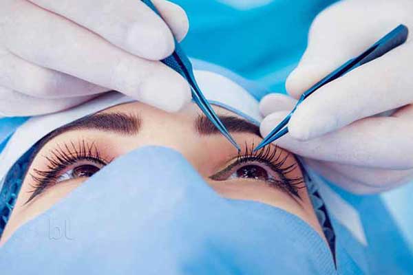 عمليات التجميل للنساء