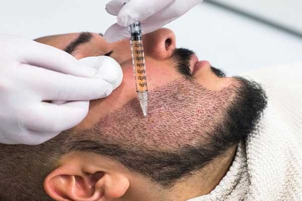 مركز زراعة الشعر