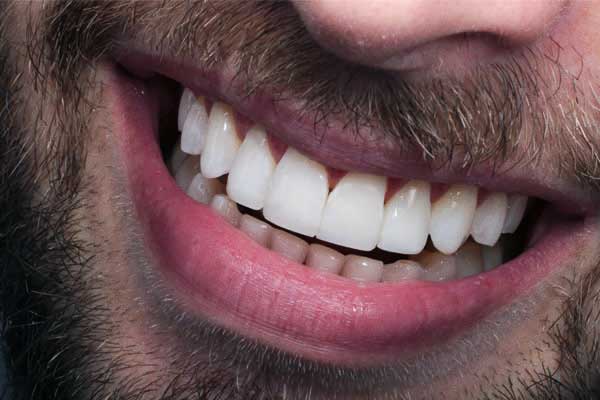 Top 5 Dental Clinics in Turkey