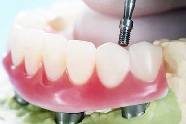 best-dentist-in-turkey-istanbul