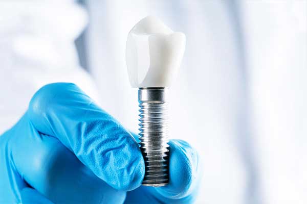 Top 10 Dental Clinics in Turkey: Your Ultimate Guide to Premium Dental Care in 2025