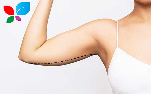 تجميل الذراعين في سوريا 2025: رحلتك نحو ذراعين مثاليتين بأفضل التقنيات والأسعار