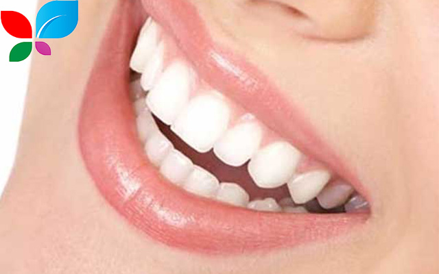 تقويم الأسنان في سوريا 2025: دليلك الشامل لابتسامة مثالية